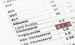 Wynik badania lipidogramu: trójglicerydy 1.5 mmol/l, co mieści się w normie u dorosłych.