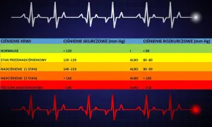 Tabela ciśnienia krwi: nadciśnienie 150/100 jak obniżyć? Wykres EKG i poziomy ciśnienia od normalnego do przełomu.