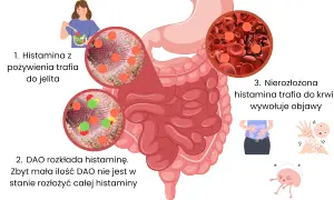Ilustracja wyjaśnia, histamina co to jest i jak wpływa na organizm: z pożywienia trafia do jelita, gdzie jest rozkładana przez DAO. Nierozłożona histamina powoduje objawy.