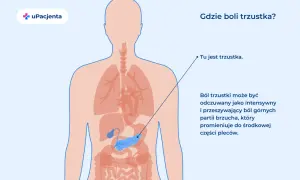 Ilustracja pokazuje lokalizację trzustki w ludzkim ciele. Ból trzustki może być intensywny i promieniować do pleców.