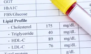 Wyniki lipidogramu: cholesterol 175 mg/dL. Kiedy się martwić? Sprawdź swoje wyniki.