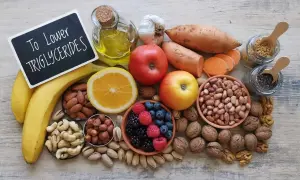Zdrowe produkty spożywcze, które pomagają obniżyć trojglicerydy 250: owoce, orzechy, nasiona, fasola, bataty, czosnek, oliwa.