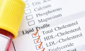Próbka krwi i formularz Lipid Profile. Wyniki badania pomogą ustalić, co podwyższa cholesterol.
