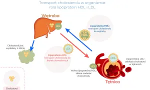 Ilustracja pokazuje transport cholesterolu, wyjaśniając, co to jest dyslipidemia. HDL transportuje cholesterol do wątroby, a LDL do tkanek, odkładając go w tętnicach.
