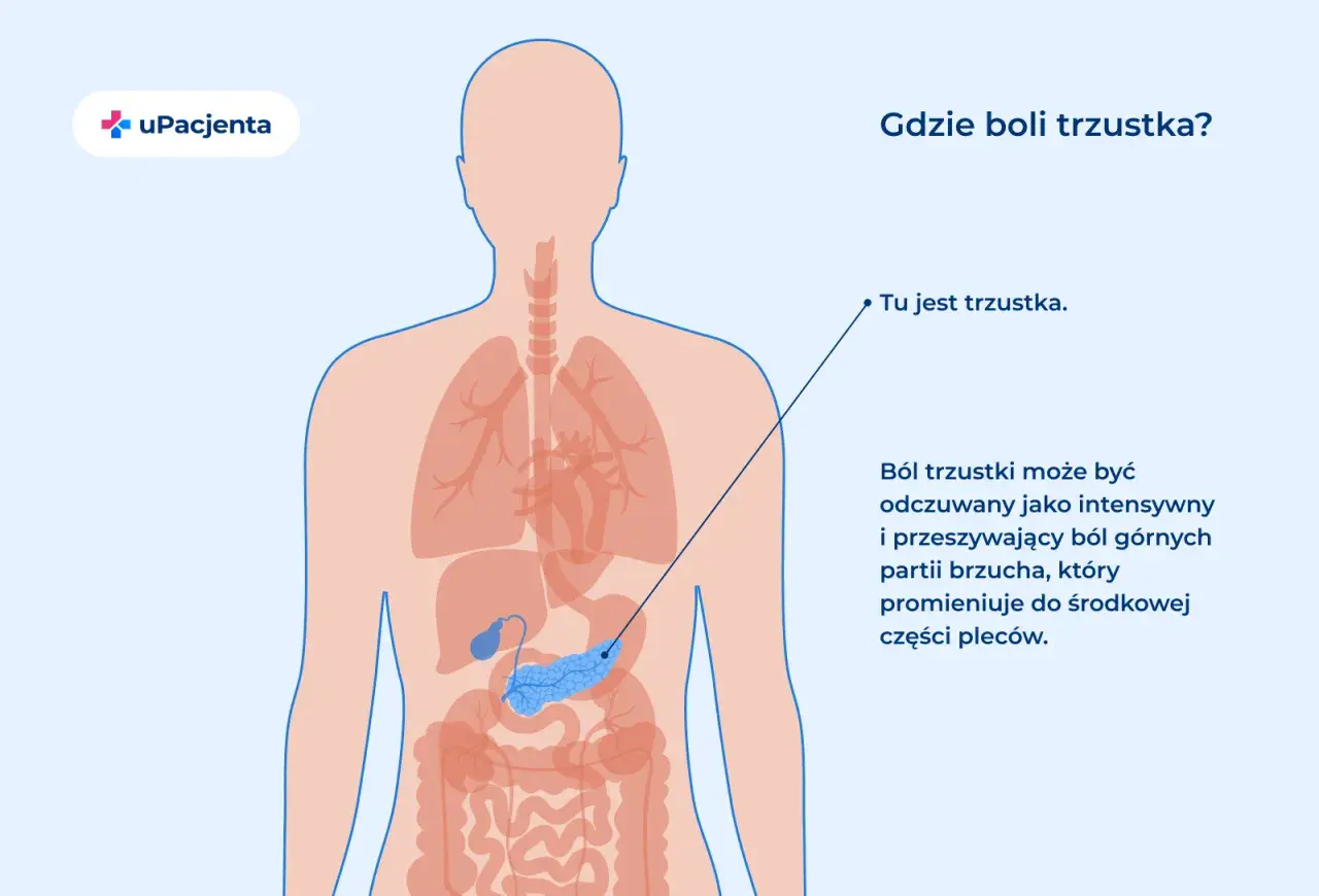 Ilustracja pokazuje lokalizację trzustki w ludzkim ciele. Ból trzustki może być intensywny i promieniować do pleców.