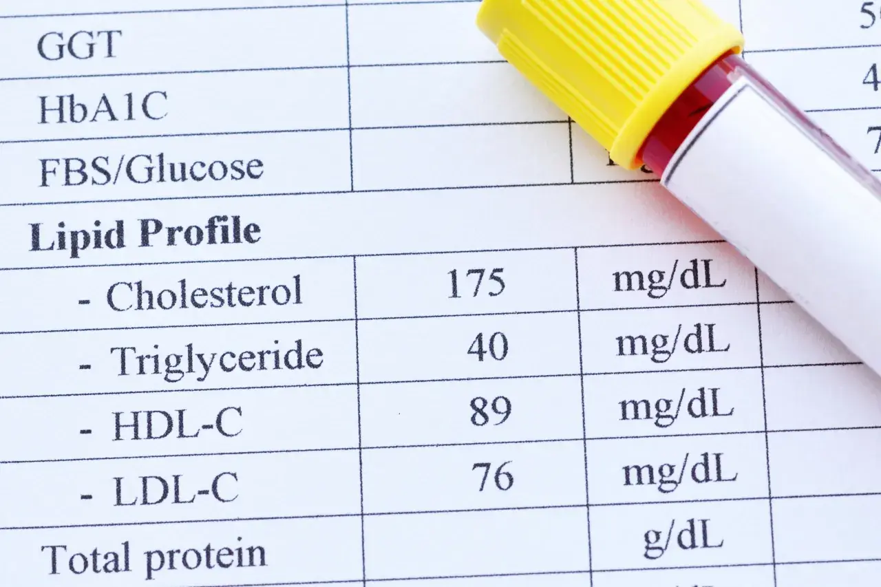 Wyniki lipidogramu: cholesterol 175 mg/dL. Kiedy się martwić? Sprawdź swoje wyniki.