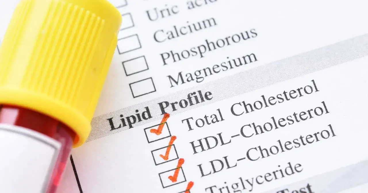 Próbka krwi i formularz Lipid Profile. Wyniki badania pomogą ustalić, co podwyższa cholesterol.