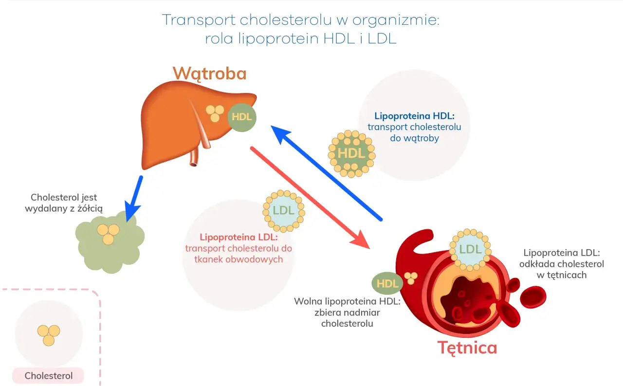 Ilustracja pokazuje transport cholesterolu, wyjaśniając, co to jest dyslipidemia. HDL transportuje cholesterol do wątroby, a LDL do tkanek, odkładając go w tętnicach.