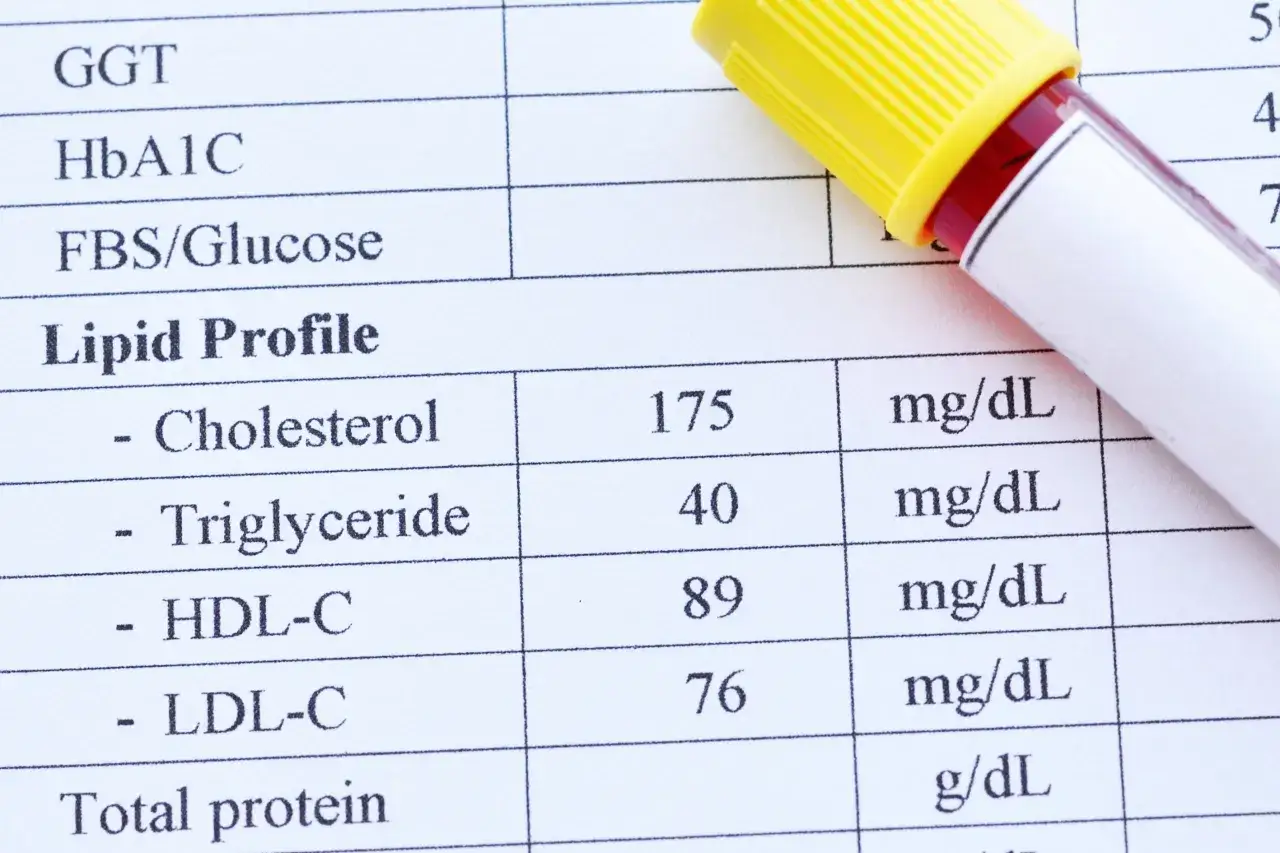 Wyniki lipidogramu pokazują, że dyslipidemia co to jest, może być związana z poziomem cholesterolu i trójglicerydów.